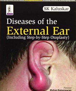 Diseases Of The External Ear (Including Step-By-Step Otoplasty) (PDF)