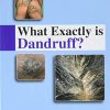 What Exactly is Dandruff (PDF)