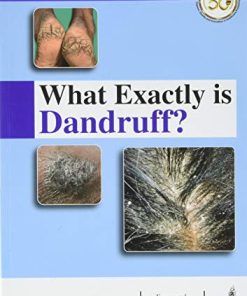 What Exactly is Dandruff (PDF)