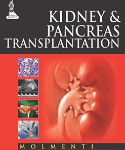 Kidney and Pancreas Transplantation (PDF)