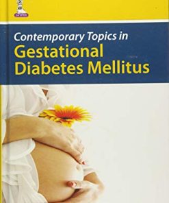 Contemporary Topics in Gestational Diabetes Mellitus (PDF)