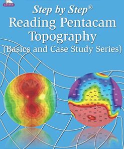 Step by Step Reading Pentacam Topography (Step by Step: Basics and Case Study), 2nd Edition (PDF)