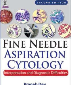 Fine Needle Aspiration Cytology: Interpretation and Diagnostic Difficulties, 2nd Edition (PDF)