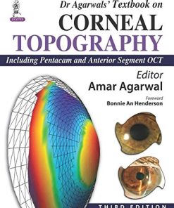 Dr Agarwals’ Textbook on Corneal Topography: Including Pentacam and Anterior Segment OCT, 3rd Edition (PDF)