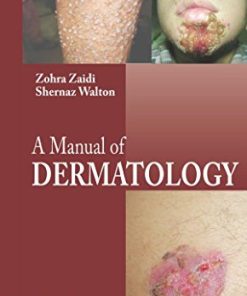 A Manual of Dermatology, 2nd Edition (PDF)