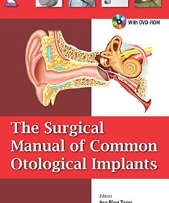 The Surgical Manual of Common Otological Implants