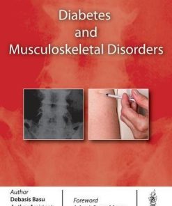 Diabetes and Musculoskeletal Disorders (PDF)