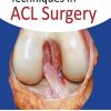 Techniques in ACL Surgery (PDF) Techniques in ACL Surgery (PDF)
