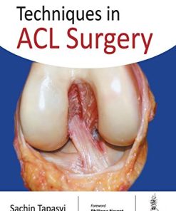 Techniques in ACL Surgery (PDF)