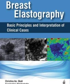 Breast Elastography: Basic Principles and Interpretation of Clinical Cases (PDF)