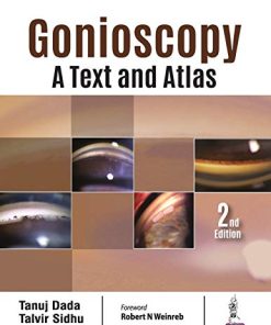 Gonioscopy: A Text and Atlas, 2nd Edition (PDF)