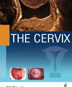 The Cervix (PDF)