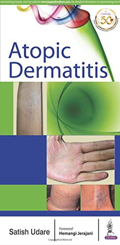 Atopic Dermatitis (PDF)