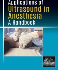 Applications of Ultrasound in Anesthesia: A Handbook (PDF)
