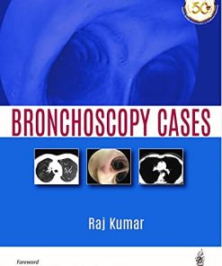 Bronchoscopy Cases (PDF)