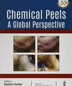 Chemical Peels: A Global Perspective (PDF)