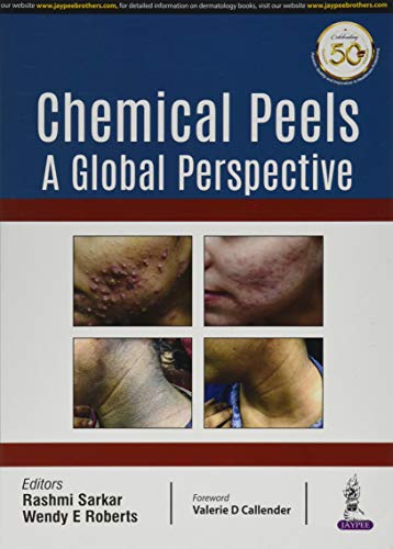 Chemical Peels: A Global Perspective (PDF) Chemical Peels: A Global Perspective (PDF)