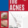 The Acnes (PDF)