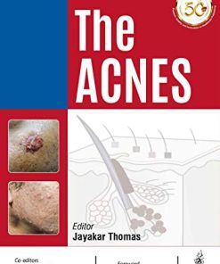 The Acnes (PDF)