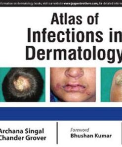 Atlas of Infections in Dermatology (PDF)