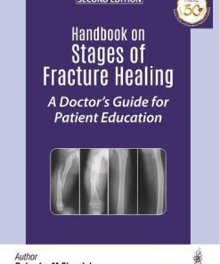 Handbook on Stages of Fracture Healing: A Doctor’s Guide for Patient Education, 2nd Edition (PDF)