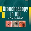 Bronchoscopy in ICU: A Practical Guide (Converted PDF)