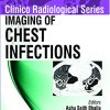 Imaging of Chest Infections (Clinico Radiological) (PDF)