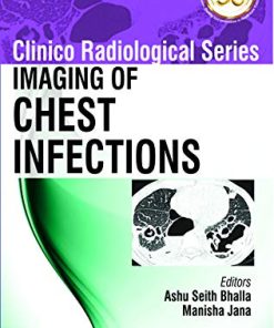 Imaging of Chest Infections (Clinico Radiological) (PDF)