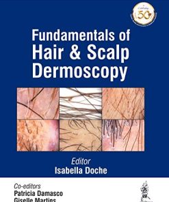 Fundamentals of Hair and Scalp Dermoscopy (PDF)