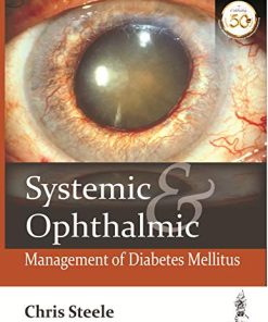 Systemic & Ophthalmic Management of Diabetes Mellitus (PDF)