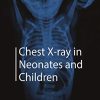 Chest X-ray in Neonates and Children (PDF)