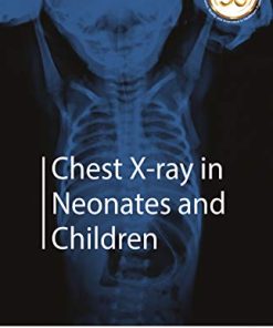 Chest X-ray in Neonates and Children (PDF)