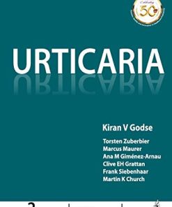 Urticaria, 2nd Edition (PDF)