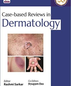 Case-Based Reviews In Dermatology (PDF)