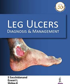Leg Ulcers: Diagnosis and Management (PDF)