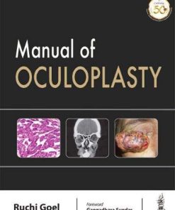 Manual of Oculoplasty (PDF)