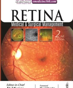 Retina: Medical & Surgical Management 2e (PDF)