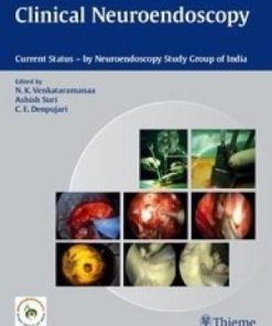 Clinical Neuroendoscopy: Current Status By Neuroendoscopy Group of India (PDF)