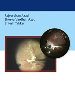 Basics of Vitrectomy (PDF)