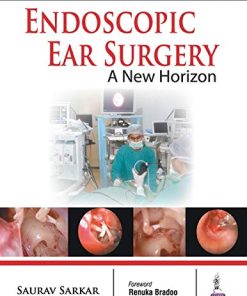 Endoscopic Ear Surgery a New Horizon (PDF)