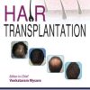 Hair Transplantation (PDF)