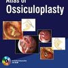 Atlas Of Ossiculoplasty (PDF)