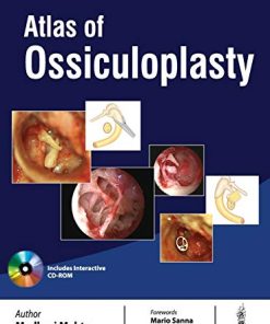 Atlas Of Ossiculoplasty (PDF)