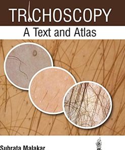 Trichoscopy: A Text and Atlas (PDF)