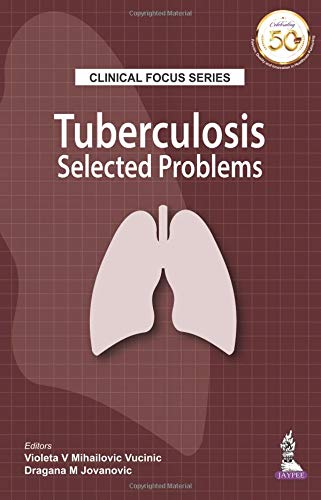 Clinical Focus Series: Tuberculosis: Selected Problems (PDF) Clinical Focus Series: Tuberculosis: Selected Problems (PDF)