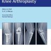 Complex Primary Total Knee Arthroplasty (PDF)