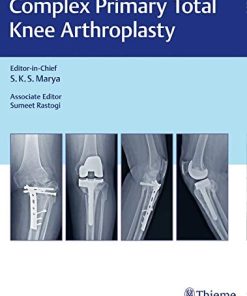 Complex Primary Total Knee Arthroplasty (PDF)