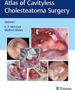 Atlas of Cavityless Cholesteatoma Surgery (Volume 1) (PDF)