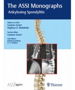 The ASSI Monographs: Ankylosing Spondylitis (PDF)