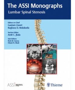 The ASSI Monographs: Lumbar Spinal Stenosis (PDF)